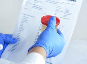 Warrant Not Required When Hospital Initiates Toxicology Test